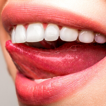 Jak na zářivě bílé zuby v domácích podmínkách? Víme, co doopravdy funguje