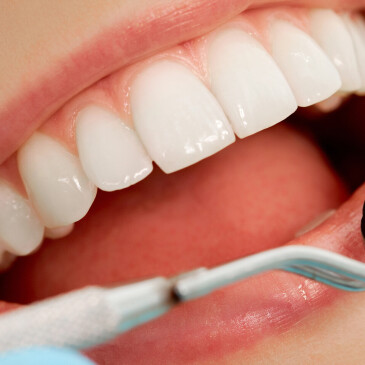 Zamezte vzniku zubního kazu dodržováním 3 jednoduchých pravidel